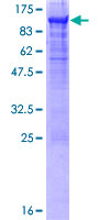 12.5% SDS-PAGE Stained with Coomassie Blue.